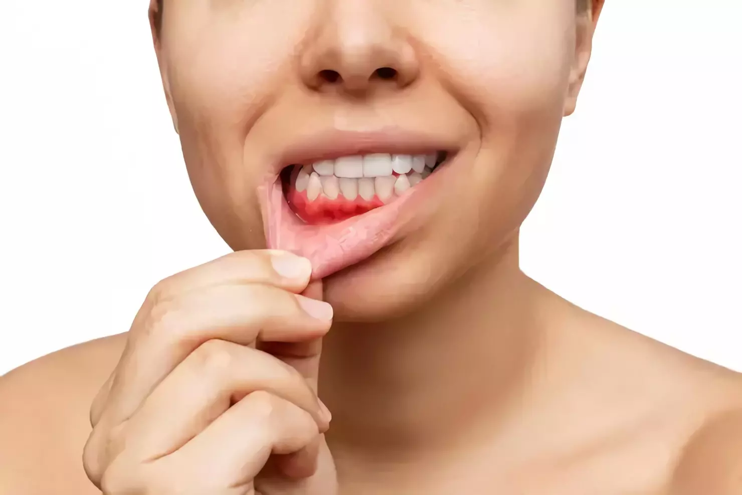 Periodoncias
